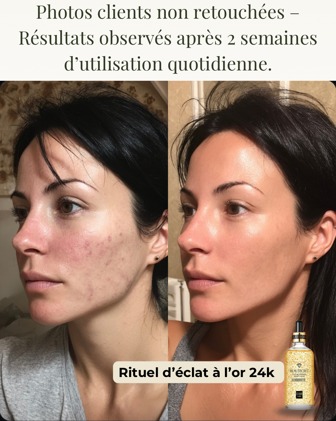 Rituel Soin Visage Anti-Âge à l’Or 24K – Éclat, Hydratation & Fermeté